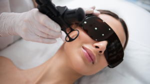 Close up top angle portrait of pretty smiling woman in eyeglasses having laser fractional rejuvenation of face in cheek zone