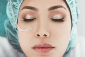 micro-needling benifite