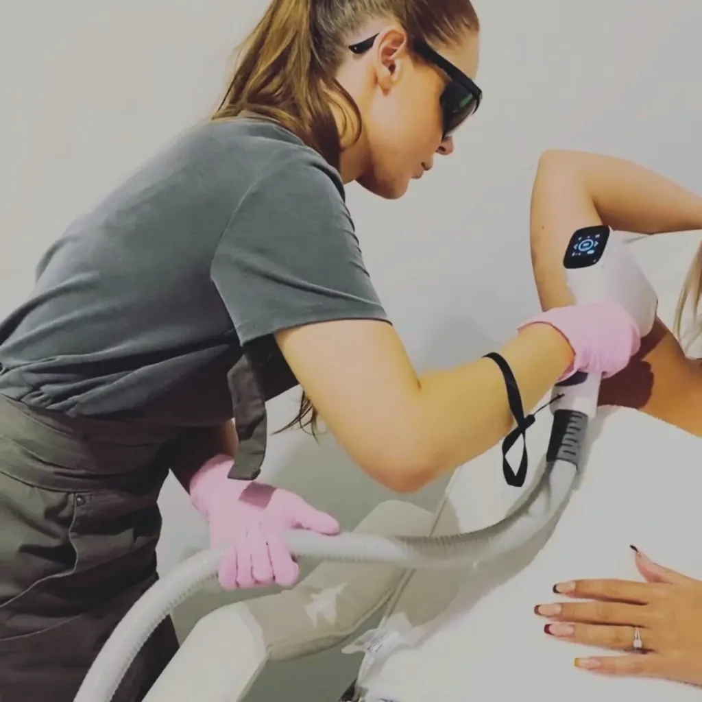 Underarm laser hair removal treatment