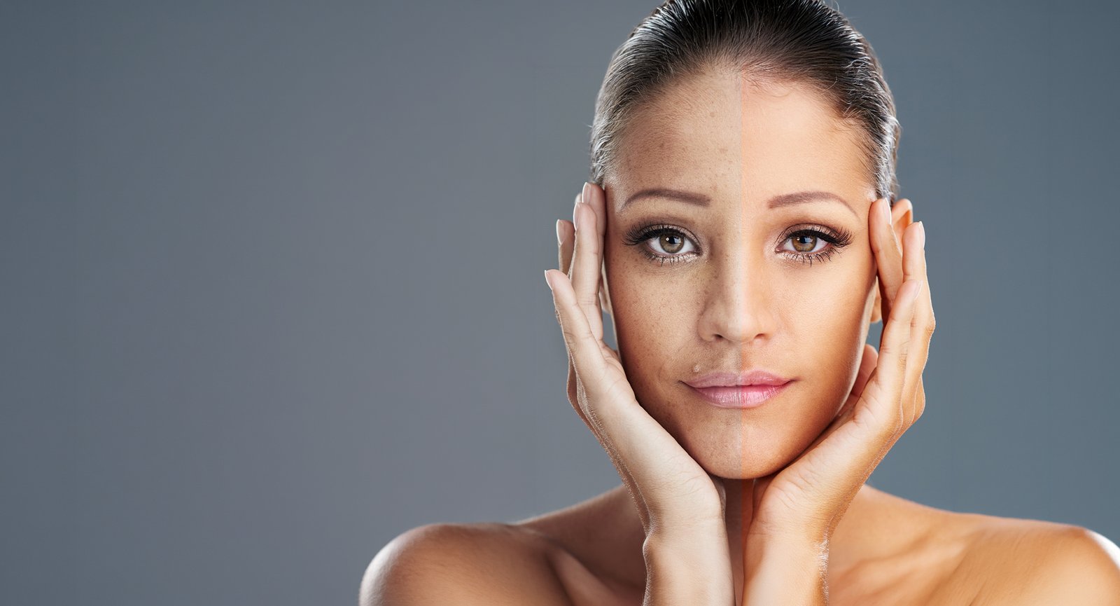 Skin elasticity on a client's face