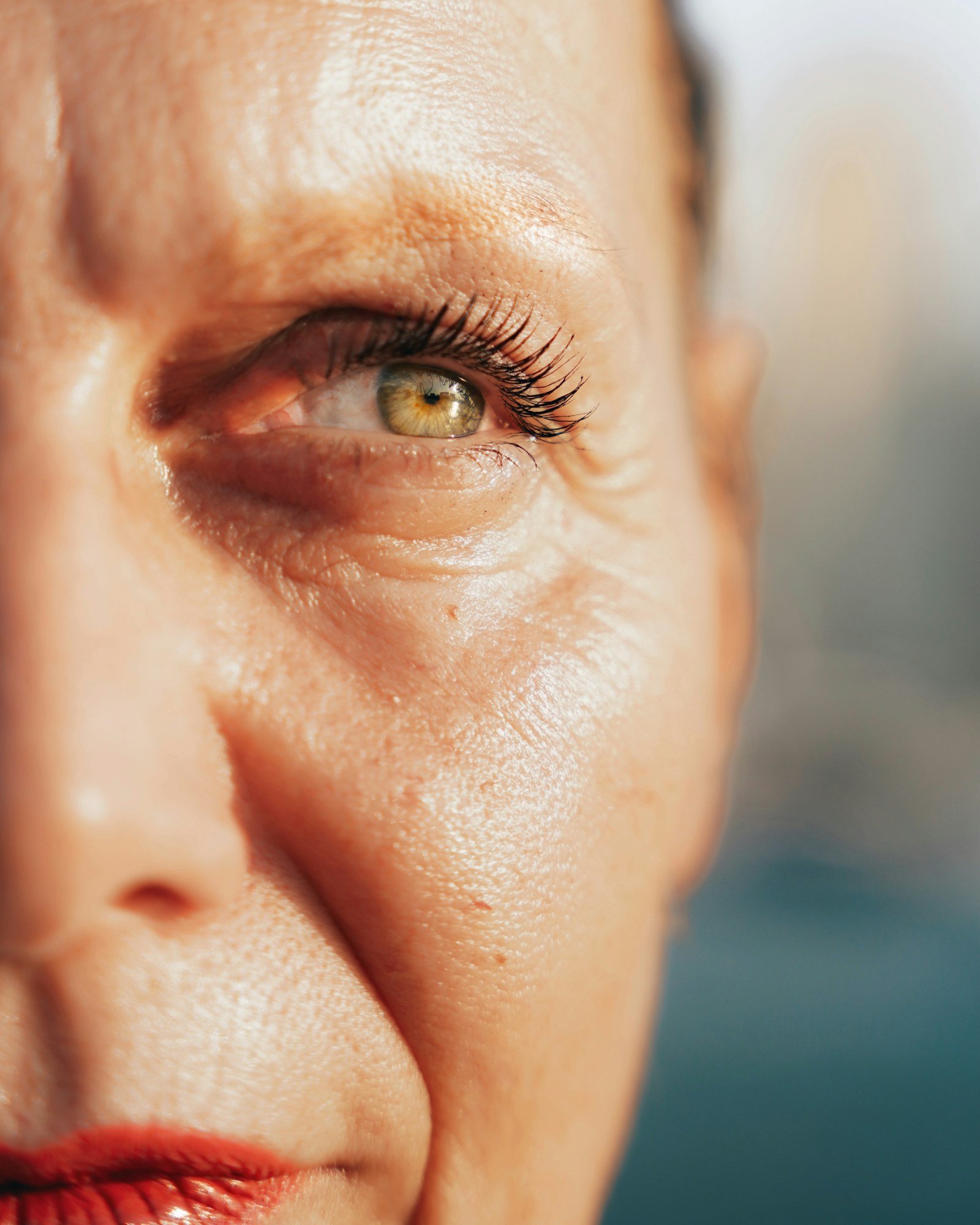Fine lines around the eyes